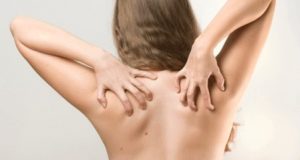 urticaria